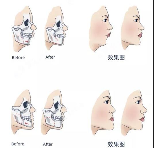 牙颌面畸形并发症及护理1