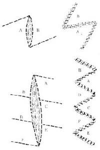 皮瓣移植各种皮瓣详介