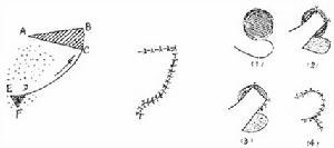 皮瓣移植分类既往的分类其一是按形态分