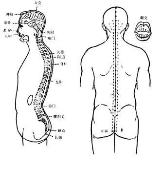 叶天士巧治难产叶桂在治疗疑难杂病方面