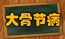 大骨节病临床表现1