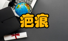 疤痕治疗常见疤痕1