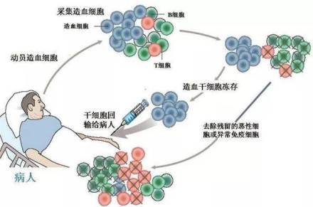 上海血液学研究所最新技术原基因干细胞造血疗法